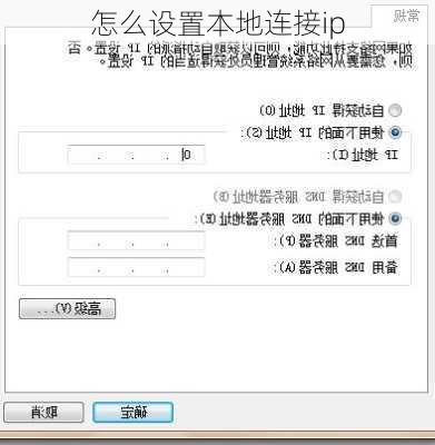 怎么设置本地连接ip